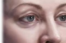 Как убрать мешки под глазами Как убрать мешки под глазами